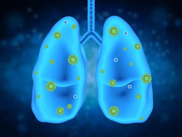 30-Year Study Finds Weekly Use Of Disinfectants Greatly Increases Your Chances Of Lung Disease