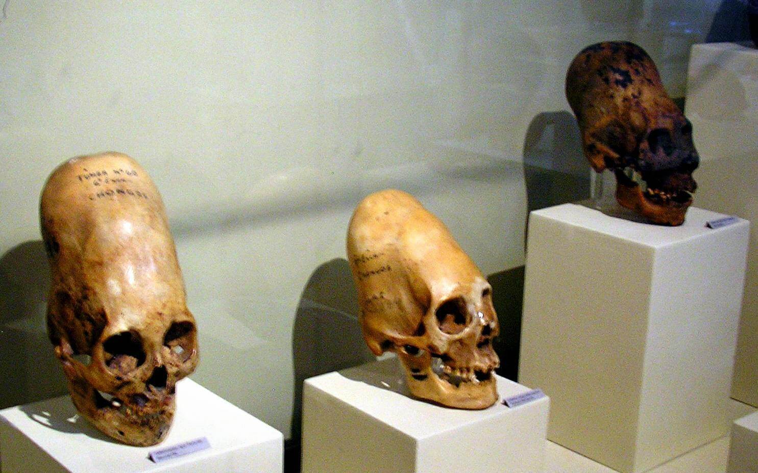 These skulls are on display at Museo Regional de Ica in the city of Ica in Peru © Wikimedia Commons