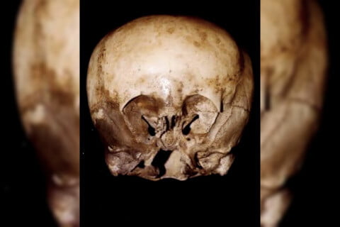 The Starchild Skull. Found in Copper Canyon, Mexico in 1920.