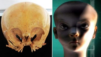 The mysterious Starchild Skull and the origin of Star Children: Who they are?