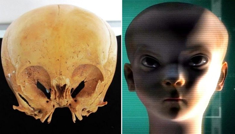 The mysterious Starchild Skull and the origin of Star Children: Who they are?