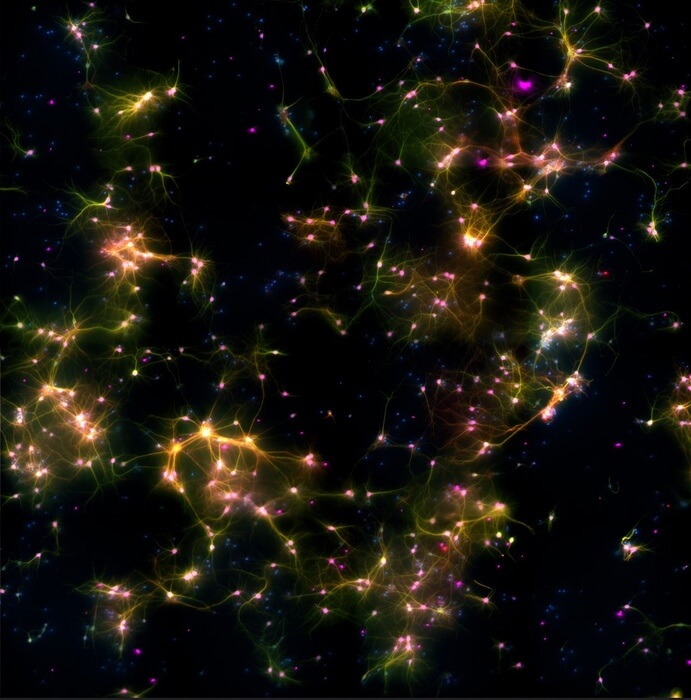 Under the microscope, tagged with fluorescent markers, the neurons, axons and dendrites glow purple, red and green.