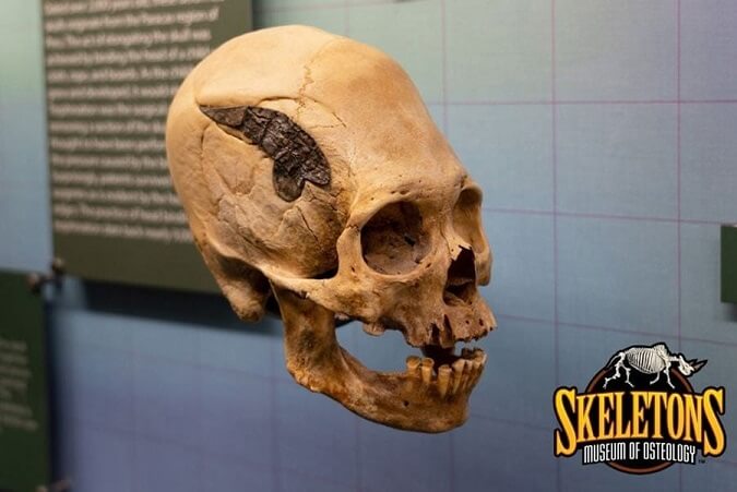 Image Credit: SKELETONS: Museum of Osteology