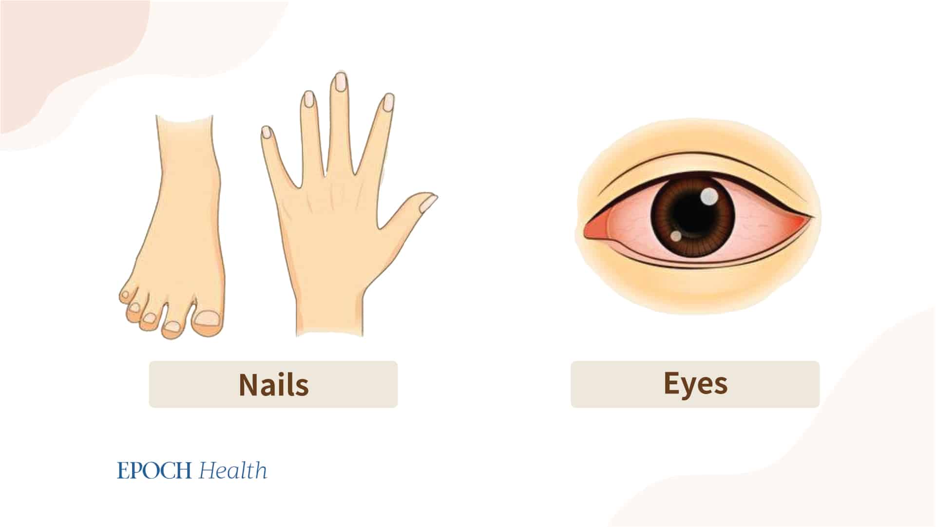 Traditional Chinese medicine can assess liver function by observing the appearance of the nails and eyes. 