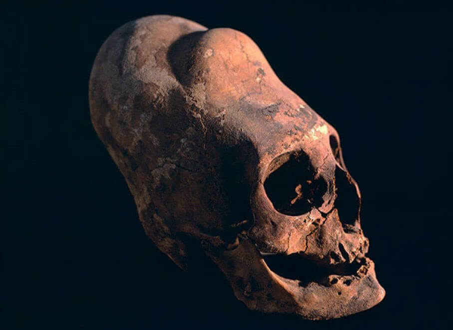 Scientists Tested The DNA of Peru’s 3,000-Year-Old Elongated Skulls — The Results Were Terrifying